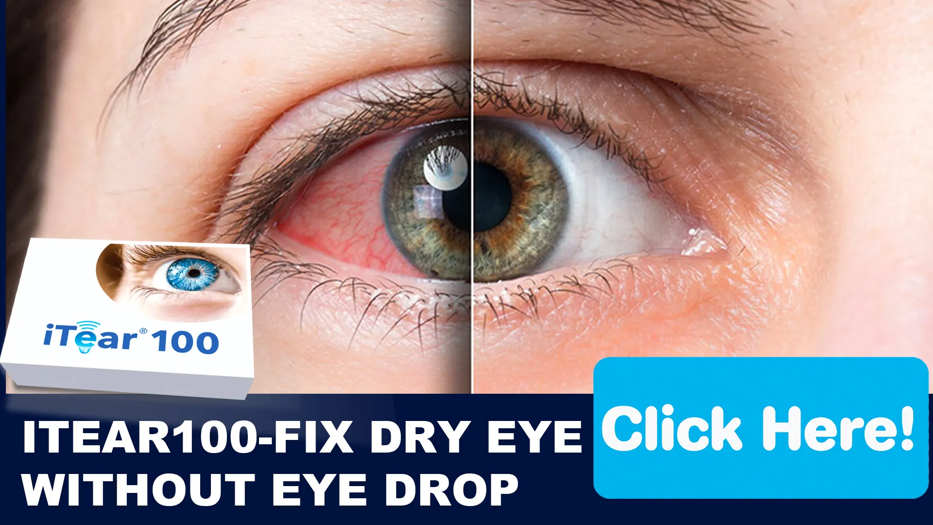The Role of iTear100



 in Combating Dry Eye from Poor IAQ
